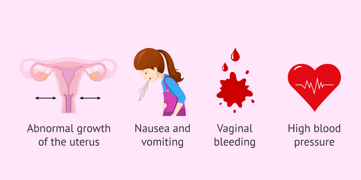بارداری پوچ متفاوت از بارداری خارج از رحم است. علائم بارداری پوچ شامل خونریزی، درد شکم و از بین رفتن درد سینه می‌شود.