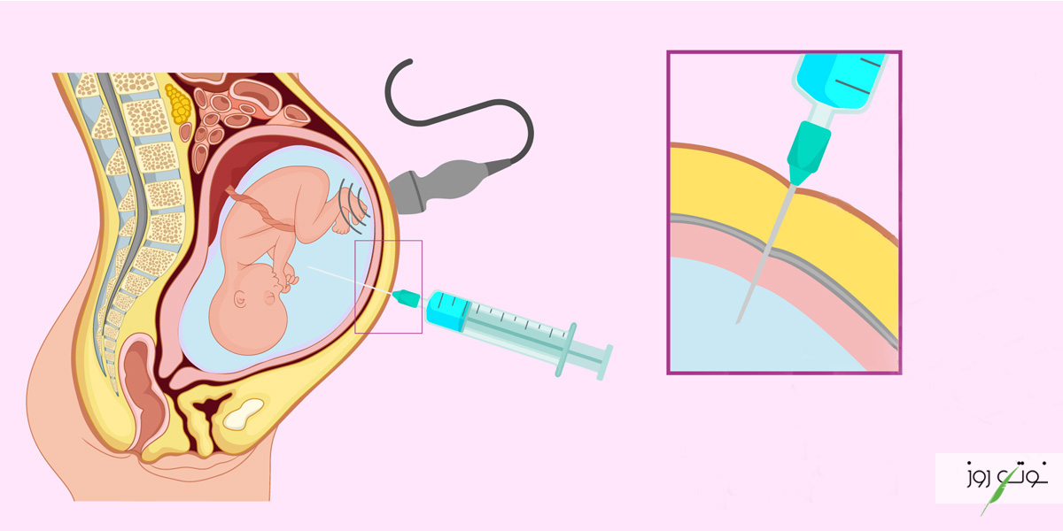 آزمایش دوران بارداری شامل موارد بسیاری از قبیل آمنیوسنتز، سونوگرافی و ... می‌شود.